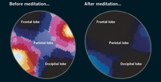 Effect of meditation on brain